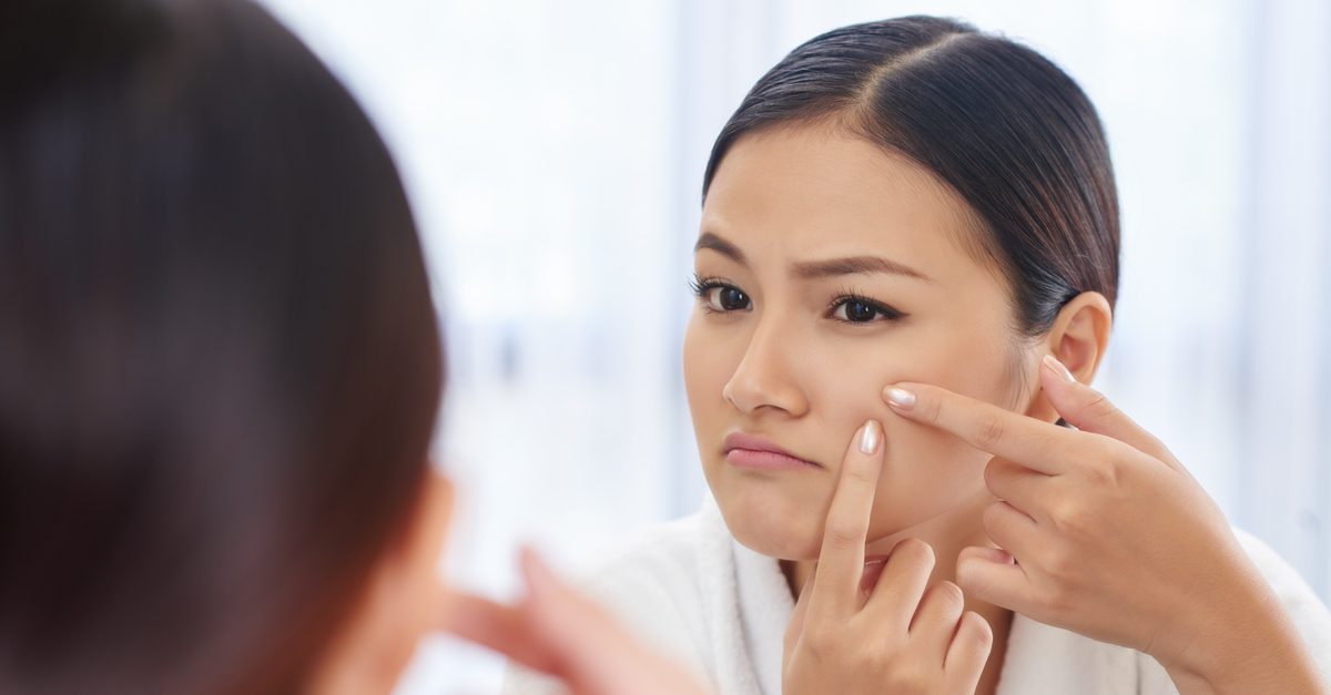 woman popping pimple