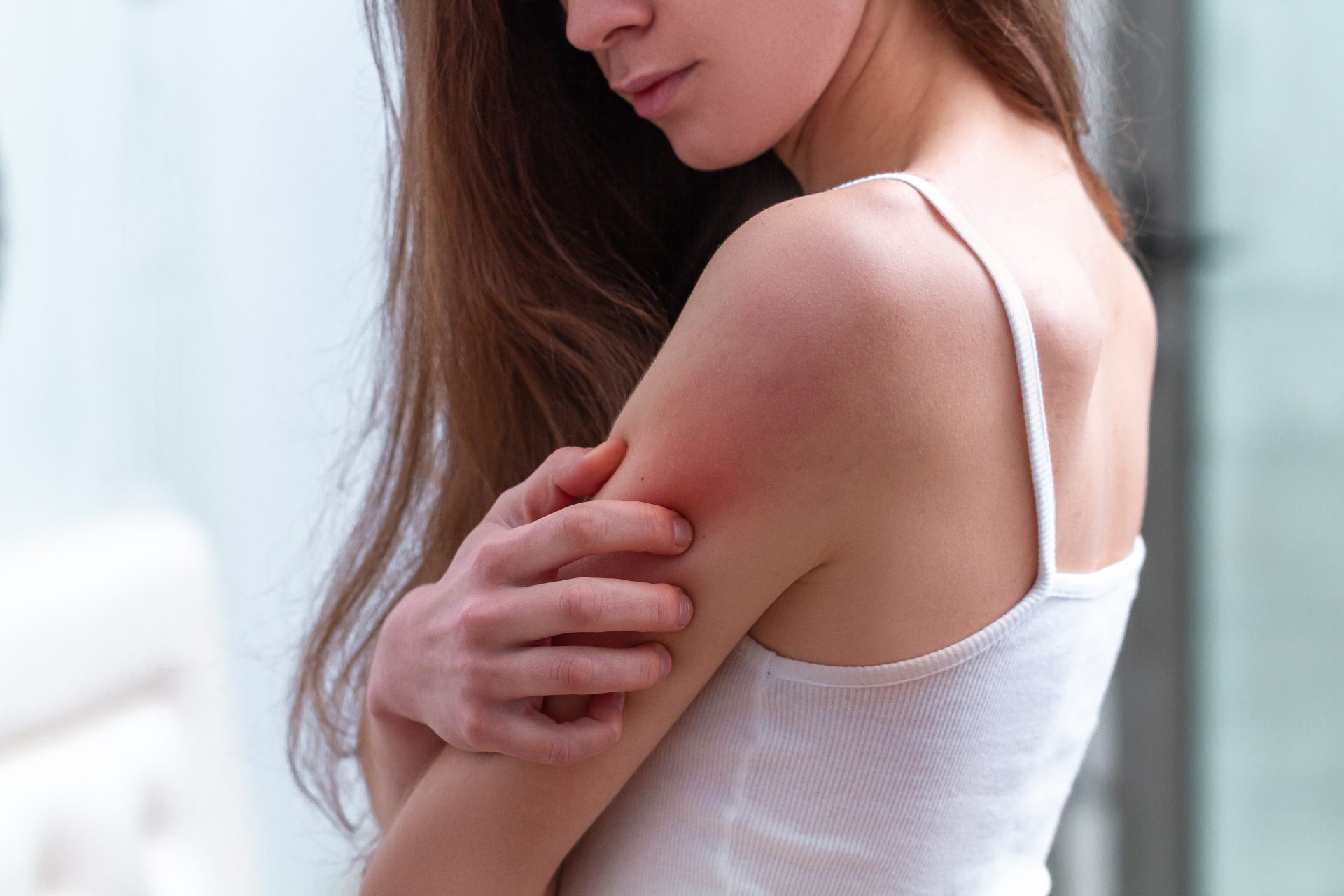 7 Most Common Travel Rashes Cahaba Dermatology Skin Health Center