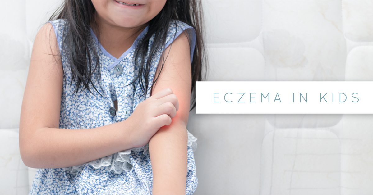 eczema in kids