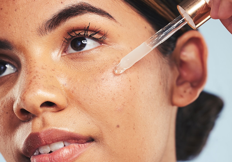 Expert Acne Treatment at Cahaba Dermatology