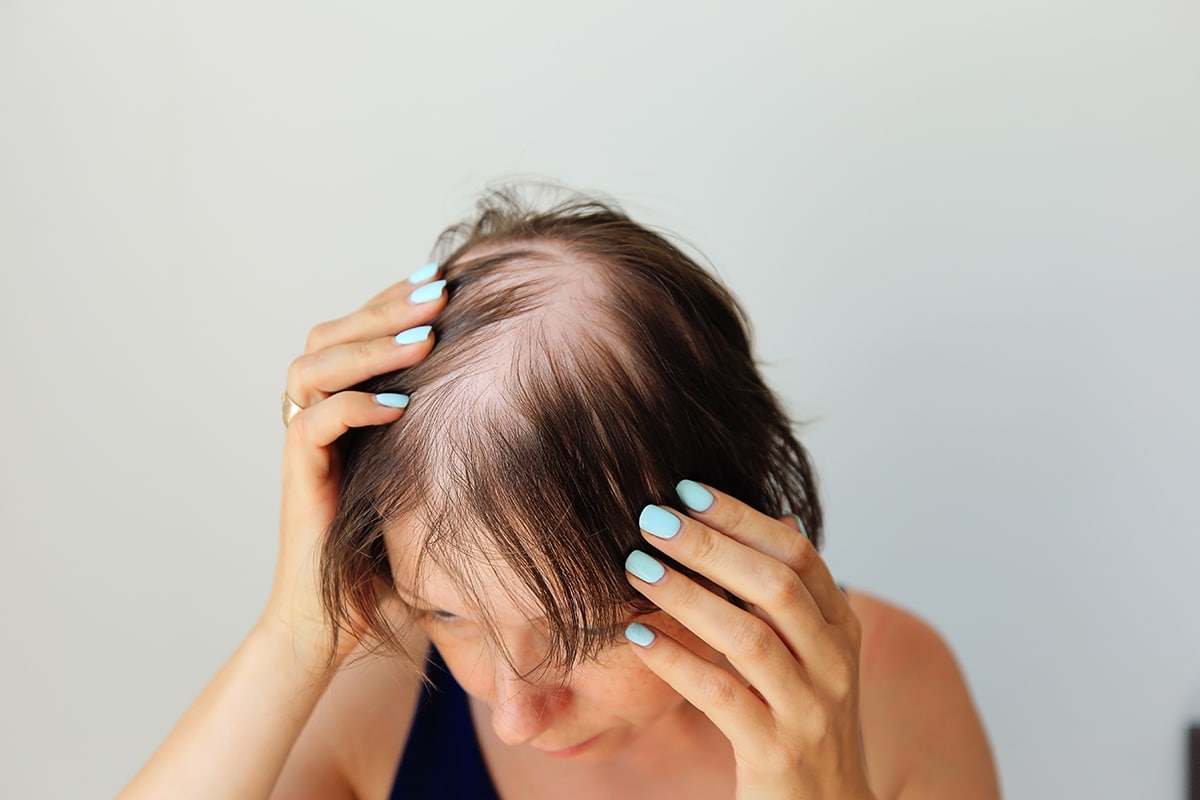 Hair Loss Treatment at Cahaba Dermatology
