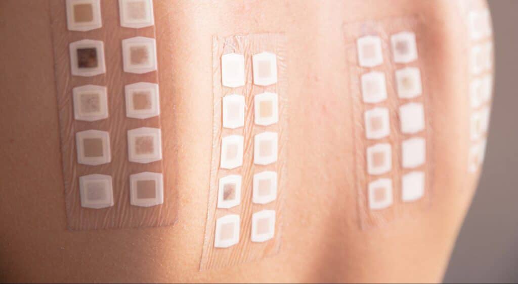 Patch Testing at Cahaba Dermatology