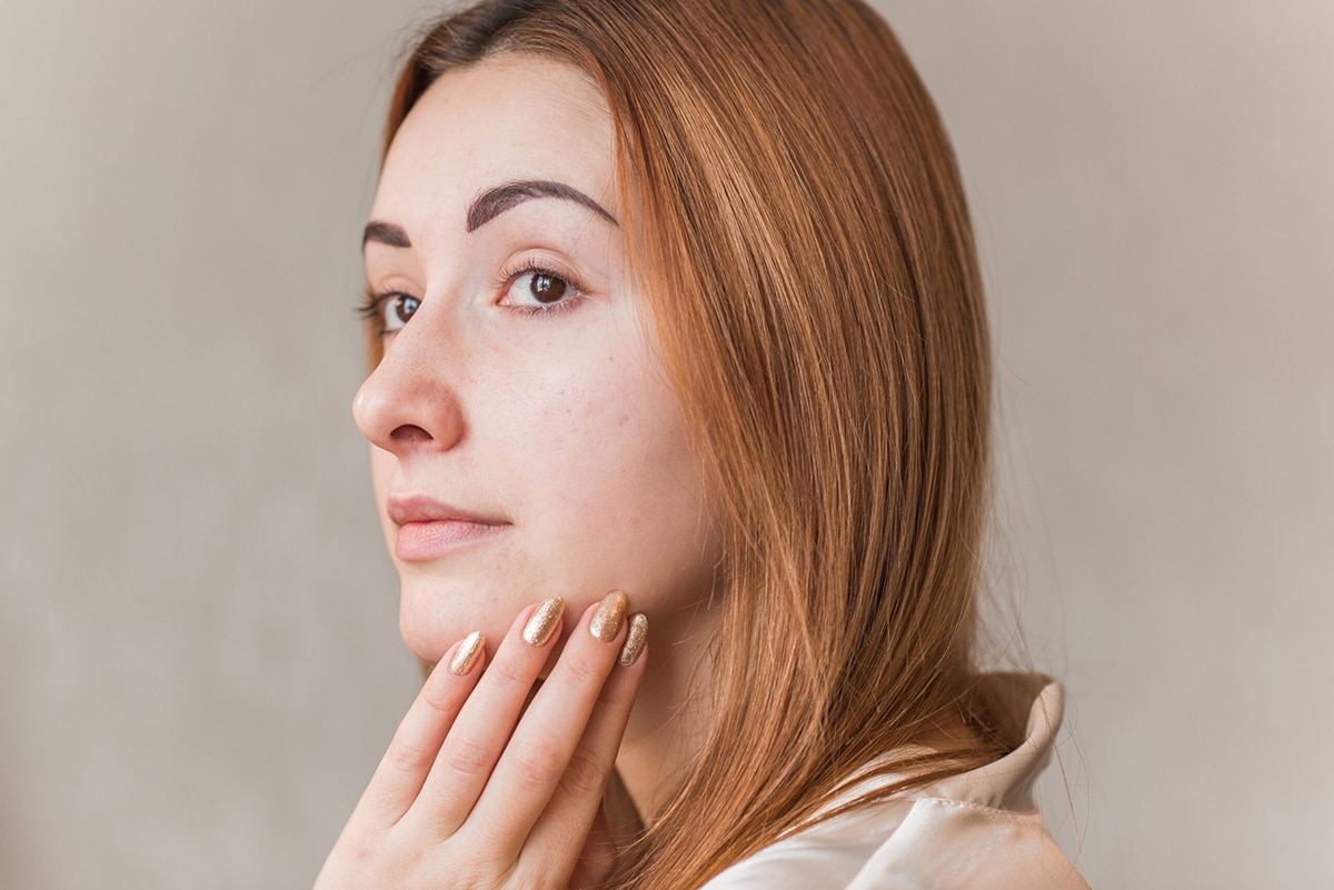 Rosacea and Triggers